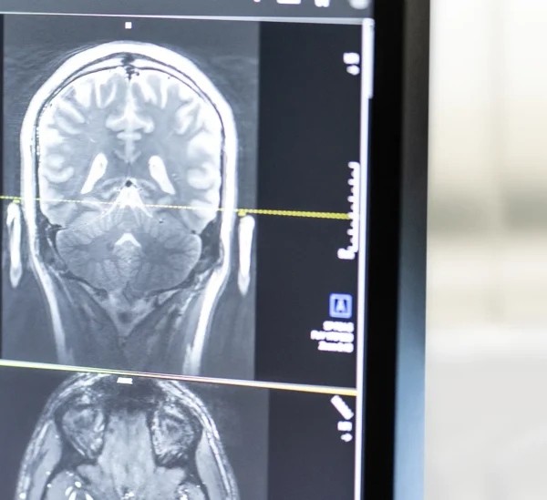 Gruppen_Neuroradiology_cropped