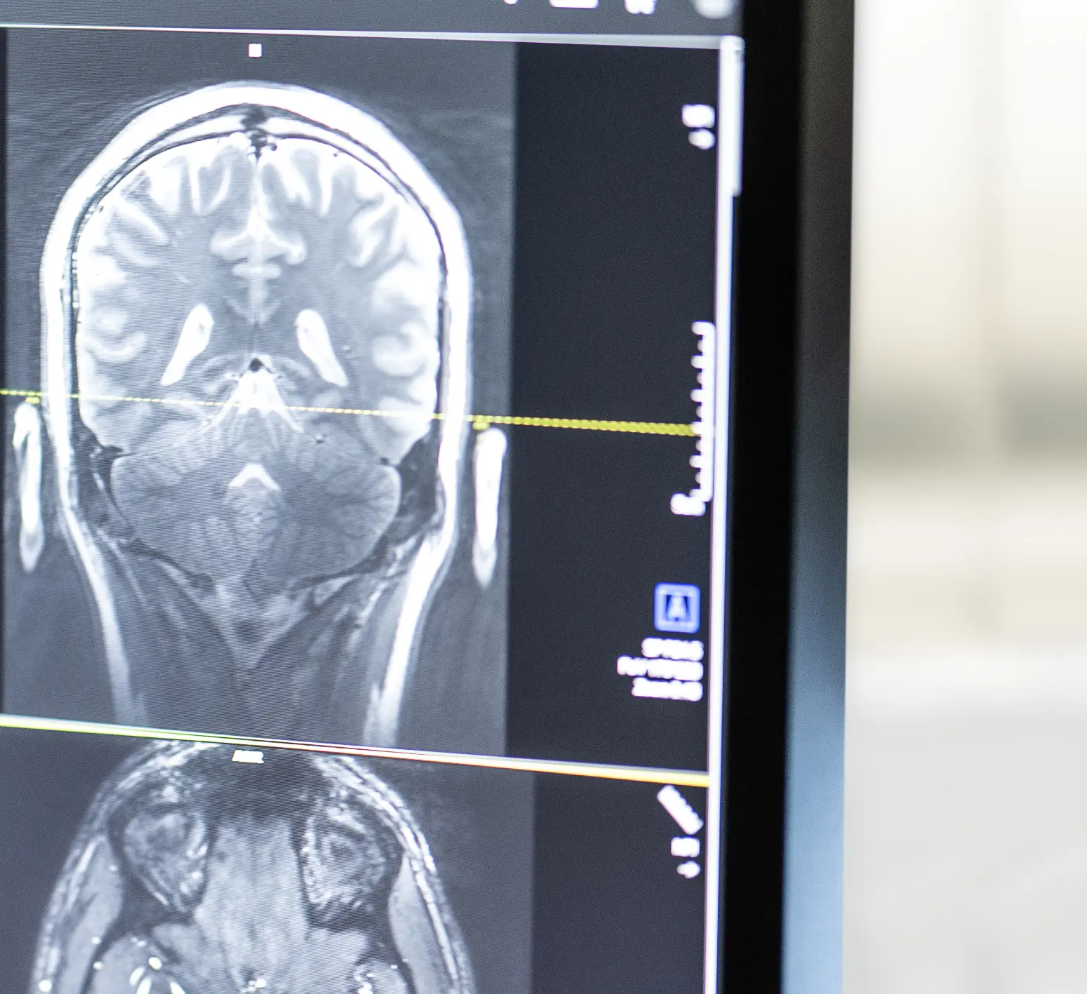 Gruppen_Neuroradiology_cropped