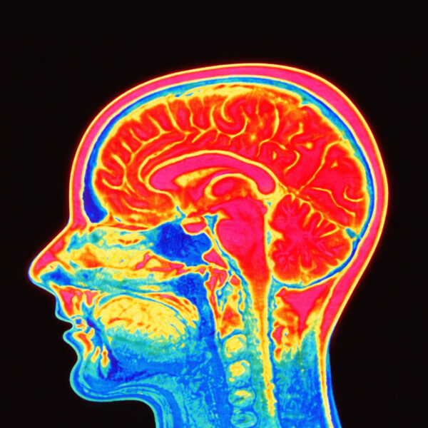 Translational Neuroscience at CoBIC